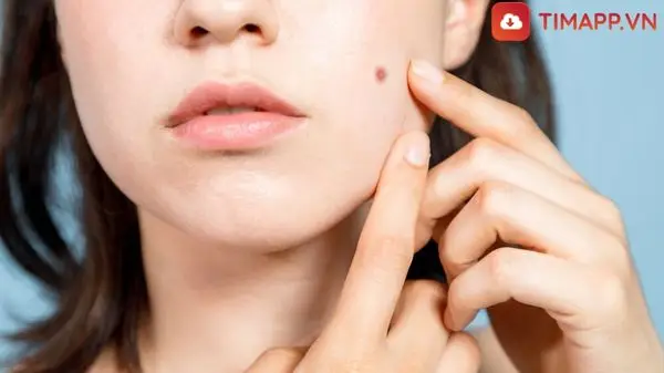 Xem bói nốt ruồi trên mặt phụ nữ chính xác 100%